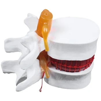 Emberi Anatómia Csontváz Gerinc Ágyéki Porckorongsérv Modell Agy Koponya Trauma Tanszerek Instrume